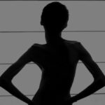 escoliose coluna desvio